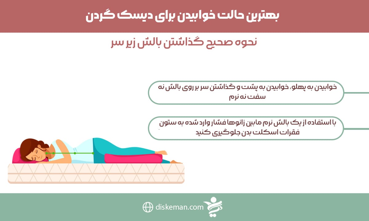 بهترین حالت خوابیدن برای دیسک گردن
